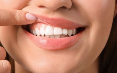 How To Take Care Of Your Gums