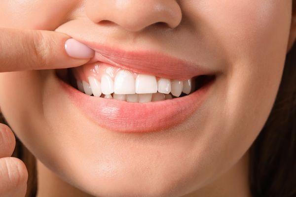 How To Take Care Of Your Gums Bakersfield Dentist How To Take Care Of Your Gums Bakersfield Dentist