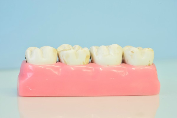 healthy foods for your teeth bakersfield dentist