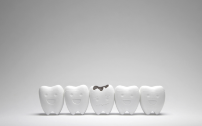 Best Way To Get Rid of Silver Fillings (Dental Amalgams)